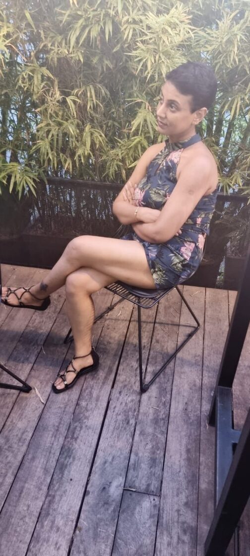 Short Dress - Image 2